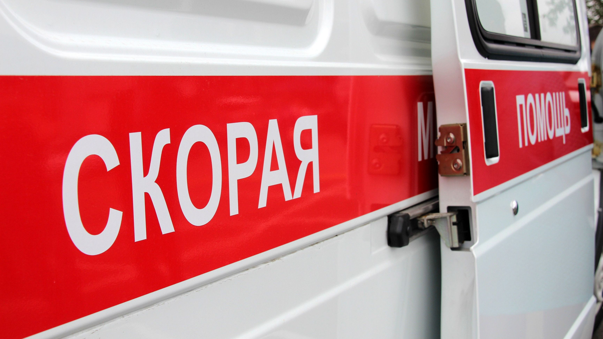 Девочка из Новосергиевского района госпитализирована с ожогами