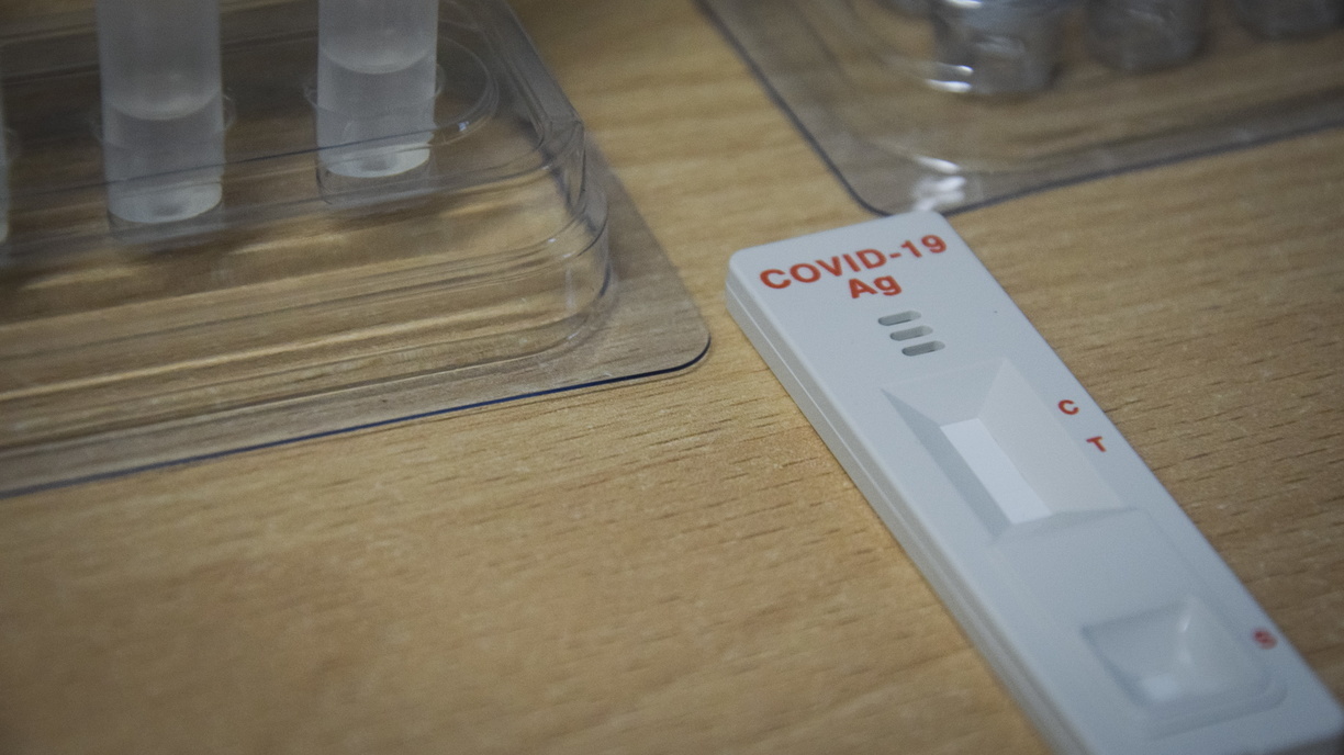 В Оренбуржье за сутки коронавирусом заболели еще 82 человека