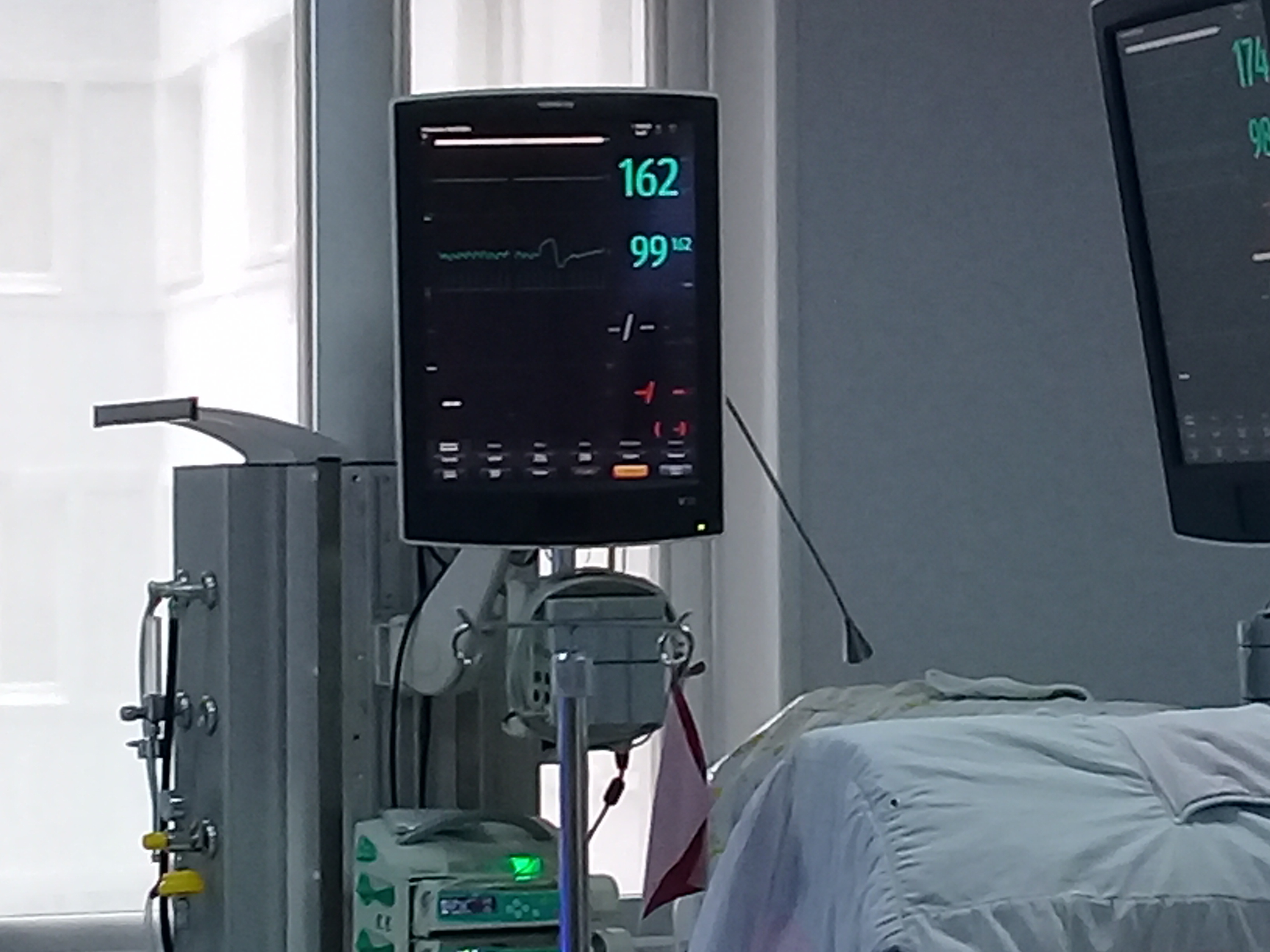 В Оренбуржье 340 пациентов с COVID в тяжелом состоянии